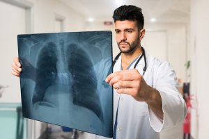 A doctor in a white coat and stethoscope around his neck is examining a chest X-ray image closely in a medical facility. Focused, he holds the X-ray up to better view it, looking for any signs of COVID-19. The background shows a hallway filled with medical equipment.