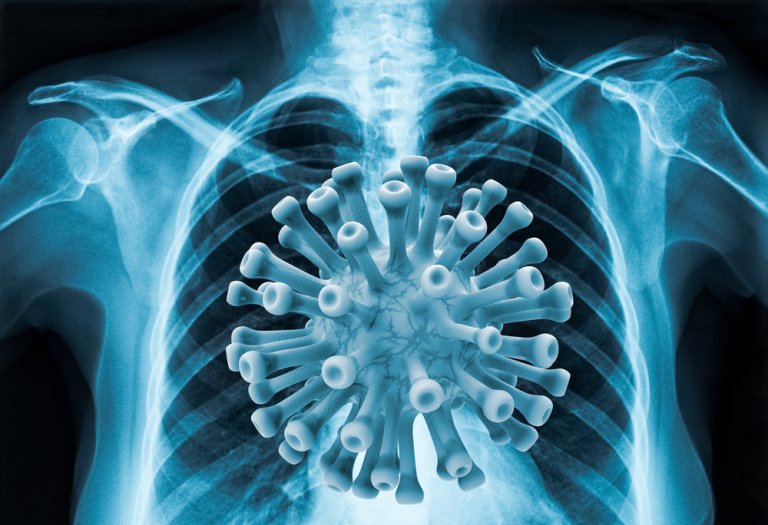 An X-ray of a human chest is overlaid with an illustration of a large COVID-19 virus particle in the central region, creating a visual representation of the virus's impact on the respiratory system.